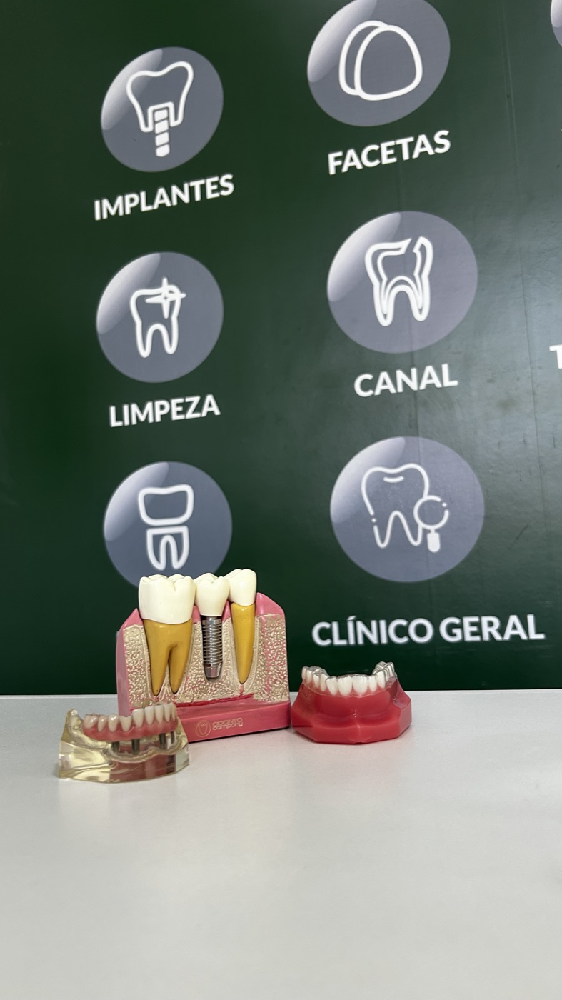 Modelo de implante dentário usado na explicação do tratamento